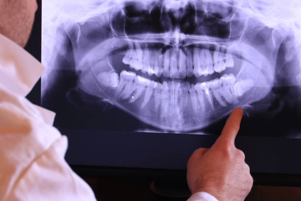 Best Emergency Root Canal Treatment in Brownfields, LA